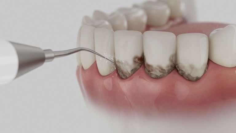 Trusted Teeth Cleaning And Checkup service in Tonopah, NV - Dentist Open Now